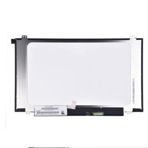 Lenovo Ideapad 100 15IBD Top Panel dealers price in hyderabad, telangana, andhra, vijayawada, secunderabad, warangal, nalgonda, nizamabad, guntur, tirupati, nellore, vizag, india